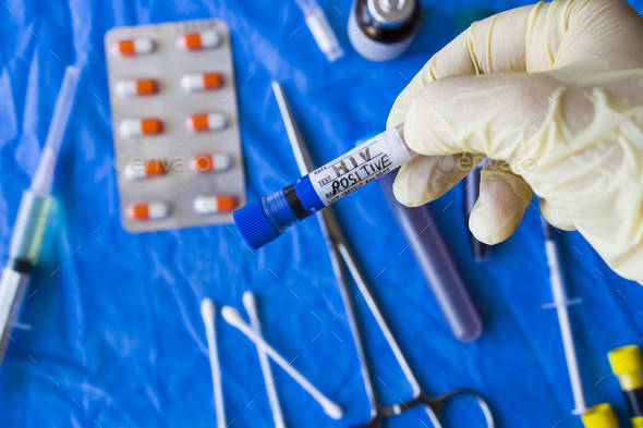 Closeup of a doctor with a latex glove holding an HIV positive test tube in the laboratory