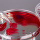 Close up lab agar with blood samples. - PhotoDune Item for Sale