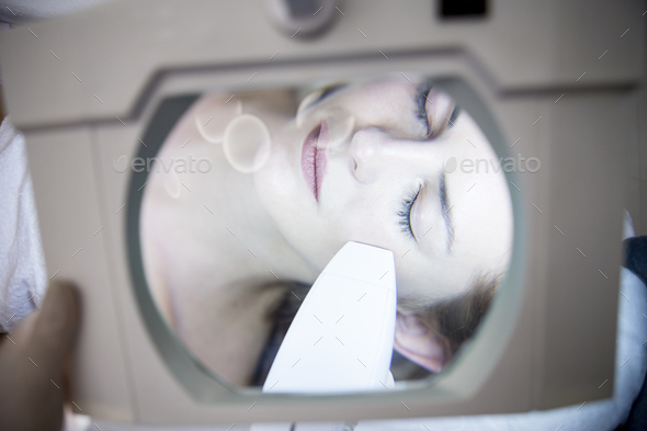Aesthetic surgery, radio frequency lifting