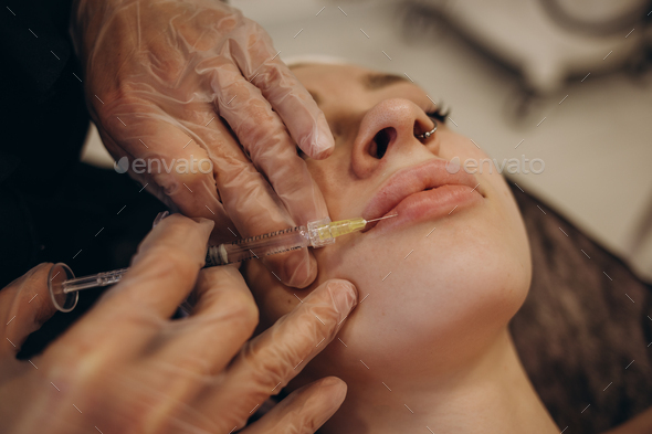 Injections of the lips. Correction form the upper lip. Injection of beauty. Spa. Facial Rejuvenation