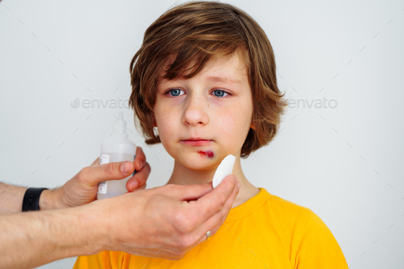 Dad doctor father treats bruised wound on his son school boy kid face. Man cleans addresses the sore