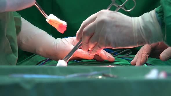 Surgical Suture Or Stitches