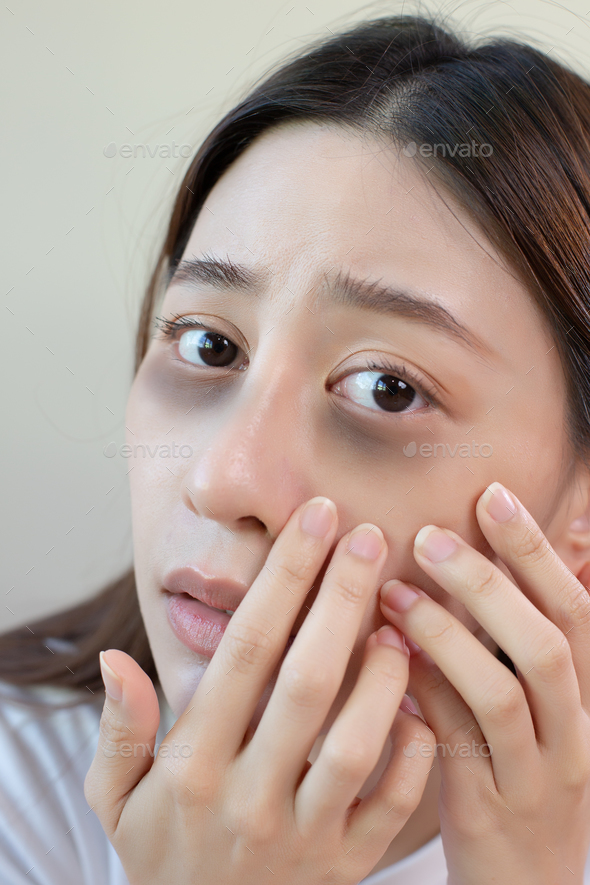 Asian young female stress looking mirror have dark eye circles from staying up sleepy late.