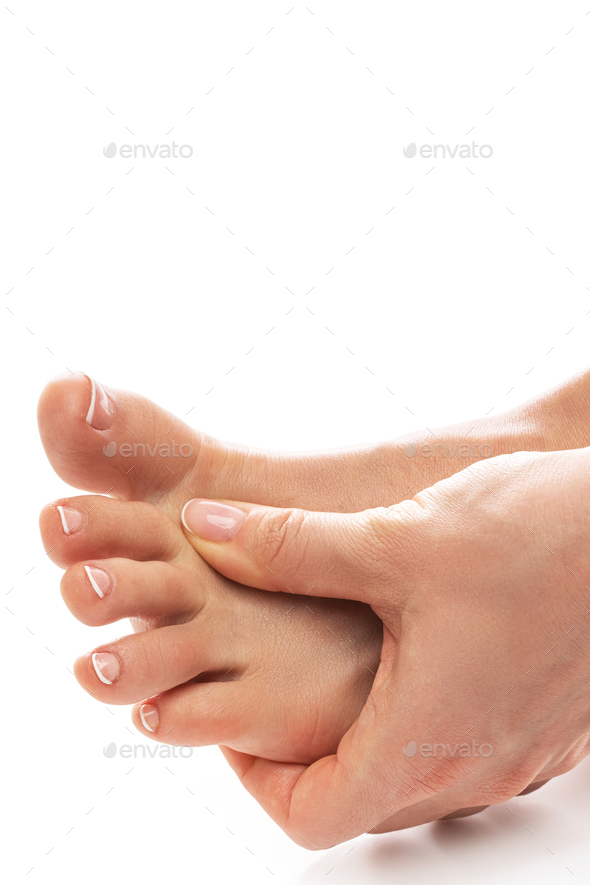 Female feet with itchy skin affected by fungal infection