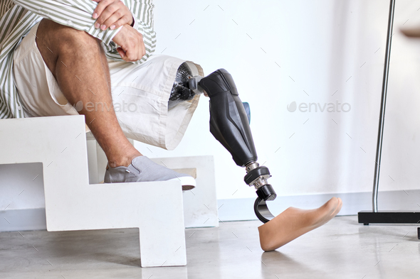 Amputee man with above knee leg prosthesis sitting on stairs, close up.