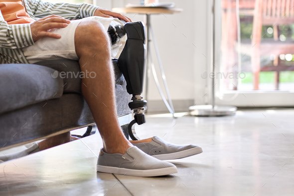 Amputee man with above knee leg prosthesis sitting on sofa, close up.