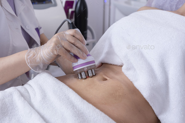 Radiofrequency body treatment of abdomen ,Non-surgical body sculpting