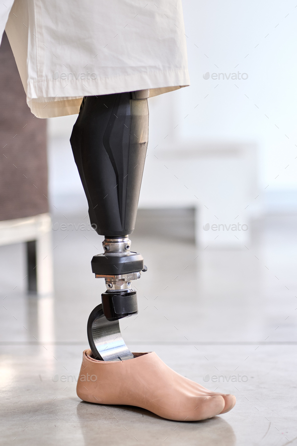 Amputee man with above knee leg prosthesis standing on foot, close up.