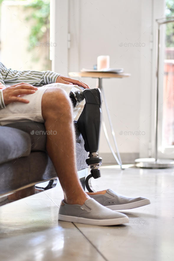 Amputee man with leg prosthesis sitting on sofa, vertical close up.