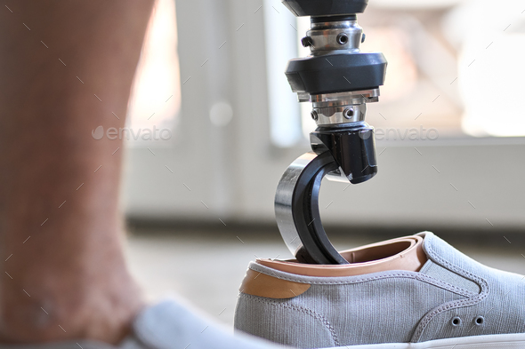 Amputee man with above knee leg prosthesis standing on feet, close up.
