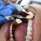Toma de color de dientes en boca de paciente - PhotoDune Item for Sale