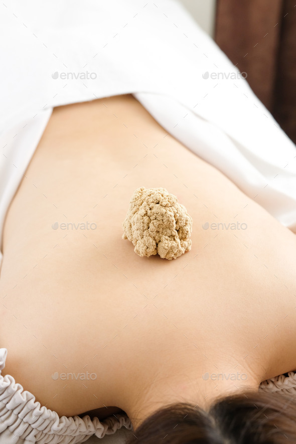 A large moxibustion placed on a woman\'s back in a bright acupuncture clinic