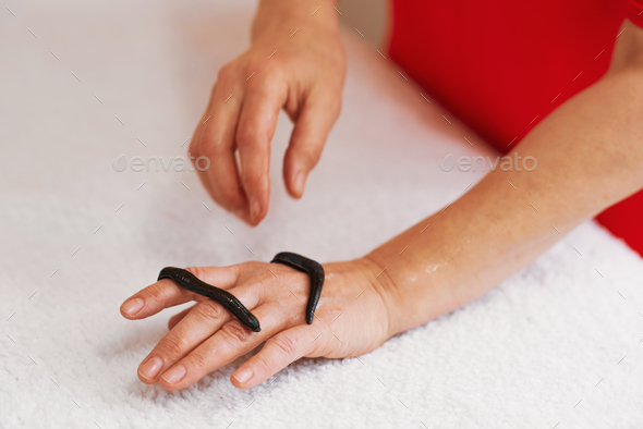 A group of leeches used for therapy - Stock Photo - Images
