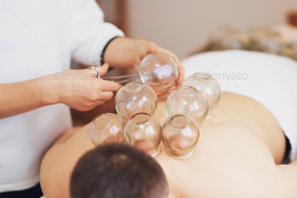 A picture of a man having cupping therapy - Stock Photo - Images