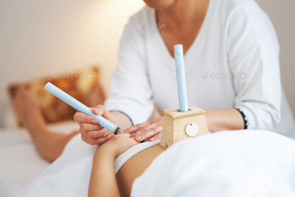 Picture of moxibustion therapy on woman body - Stock Photo - Images