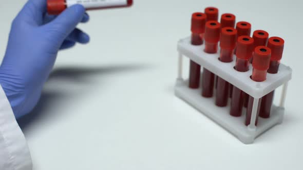 Positive HIV Viral Load Test, Doctor Showing Blood Sample in Tube, Lab Research