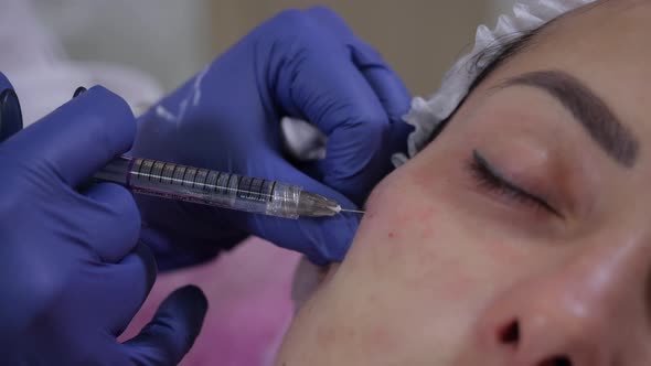 Beautician Makes Injections of Hyaluronic Acid To Young Woman