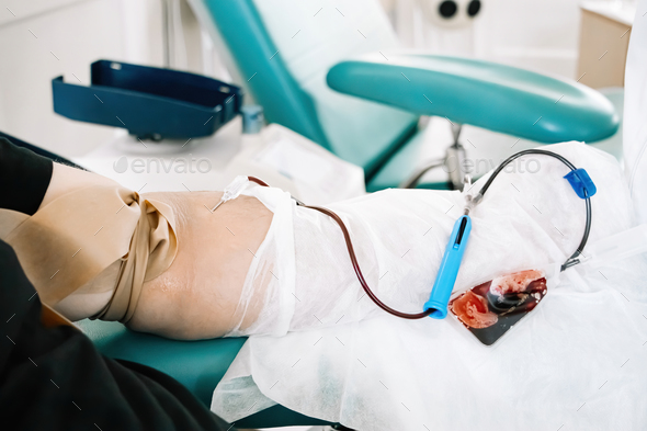 International Blood Donation Day. Man donates blood in medical laboratory. - Stock Photo - Images