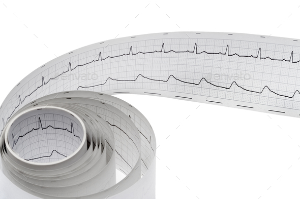 Roll of regular elektrocardiogram on white background close up - Stock Photo - Images