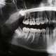 Panoramic X-ray of the jaw. X-ray of the teeth of a 12-year-old girl - PhotoDune Item for Sale