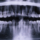 Panoramic X-ray of the jaw. X-ray of the teeth of a 12-year-old girl - PhotoDune Item for Sale