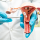 Uterus, doctor holding anatomy model for study diagnosis and treatment in hospital. - PhotoDune Item for Sale
