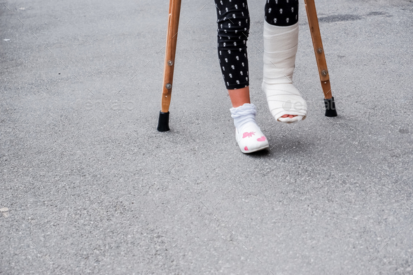 Young girl in orthopedic cast on crutches walking on the street near the road. Child with a broken