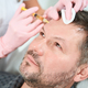 Man with unshaven face receives subcutaneous injections of frontal zone - PhotoDune Item for Sale