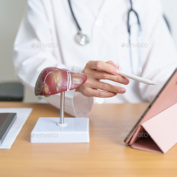 Doctor with human Liver model and tablet. Liver cancer