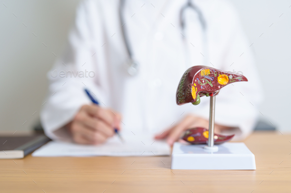 Doctor with human Liver anatomy model. Liver cancer