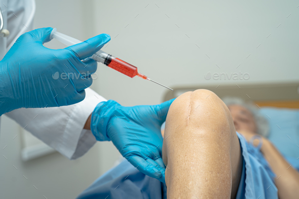 Asian doctor inject Hyaluronic acid platelet rich plasma into the knee of senior woman to walk.