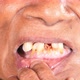 Senior Woman Showing Her Deformed Teeth - VideoHive Item for Sale