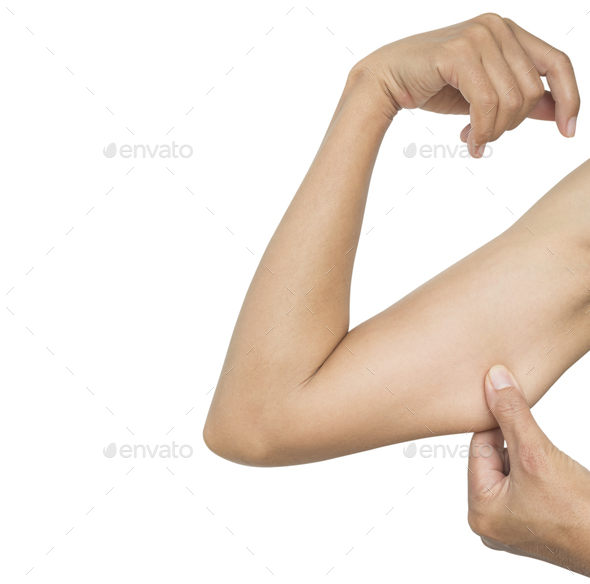 Fat Arm Woman Isolated,Surgery Liposuction Hand,Cellulite Body Obesity