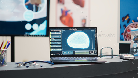 Laptop showing neural system on desk