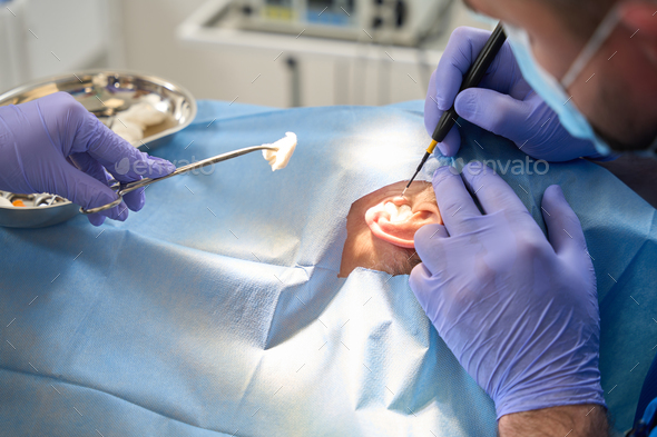 Surgeon who performs surgery on patient ear using ultrasonic knife Stock  Photo by svitlanah