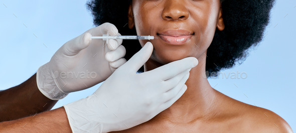 Black woman, face injection and beauty with lip filler, cosmetic procedure and dermatology on blue