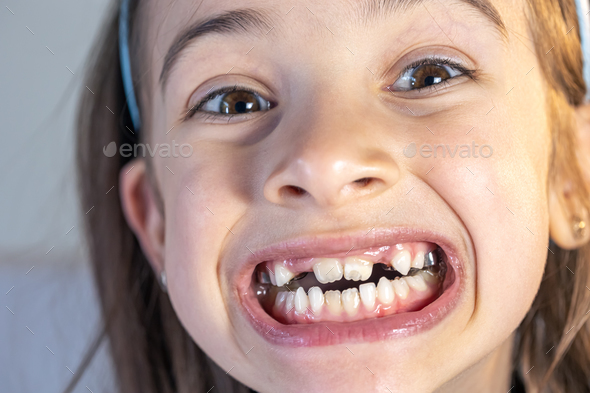 Child during orthodontist visit and oral cavity check-up. Stock Photo ...