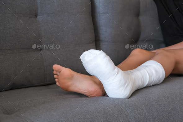 woman with Plastered Leg in a cast is recovering at home.