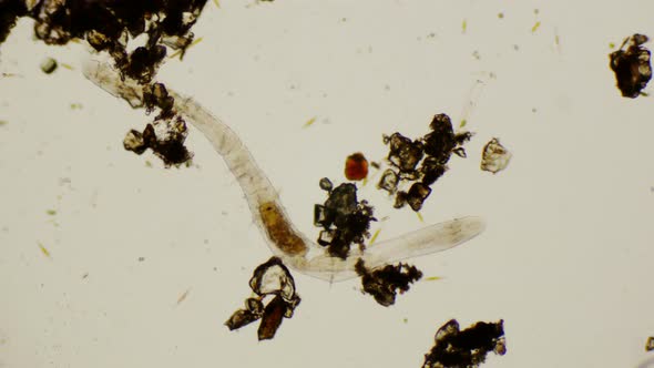 Nematode Under The Microscope alt