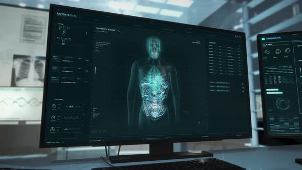 Using Advanced Computer Software In Laboratory To Make Covid-19 Diagnosis alt
