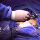 Laparoscopic Surgery 2 - VideoHive Item for Sale