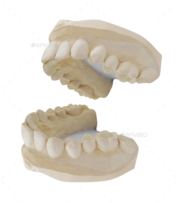 teeth mold isolated on white background Stock Photo by photobalance