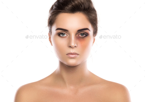 Woman with a bruise under her eye on white background Stock Photo by ...