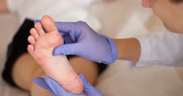 Doctor Conducts a Medical Examination and Childb Legs with Red Allergic Spots alt