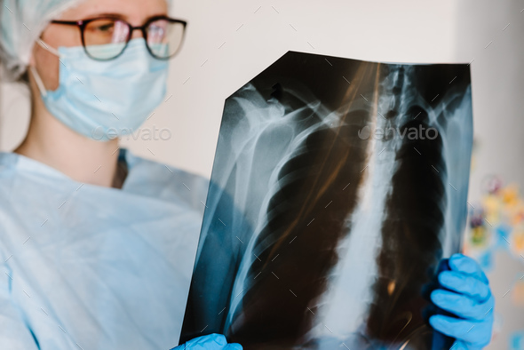 Doctor specialist pulmonary medicine holding radiological, chest x-ray film for medical diagnosis