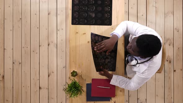 Afro American Male Doctor Looking at X-ray of a Brain alt