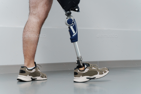 Unrecognisable male wearing prosthetic leg Stock Photo by arthurhidden