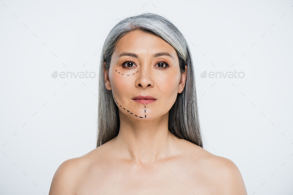 Attractive Naked Asian Woman With Plastic Surgery Lines On Face