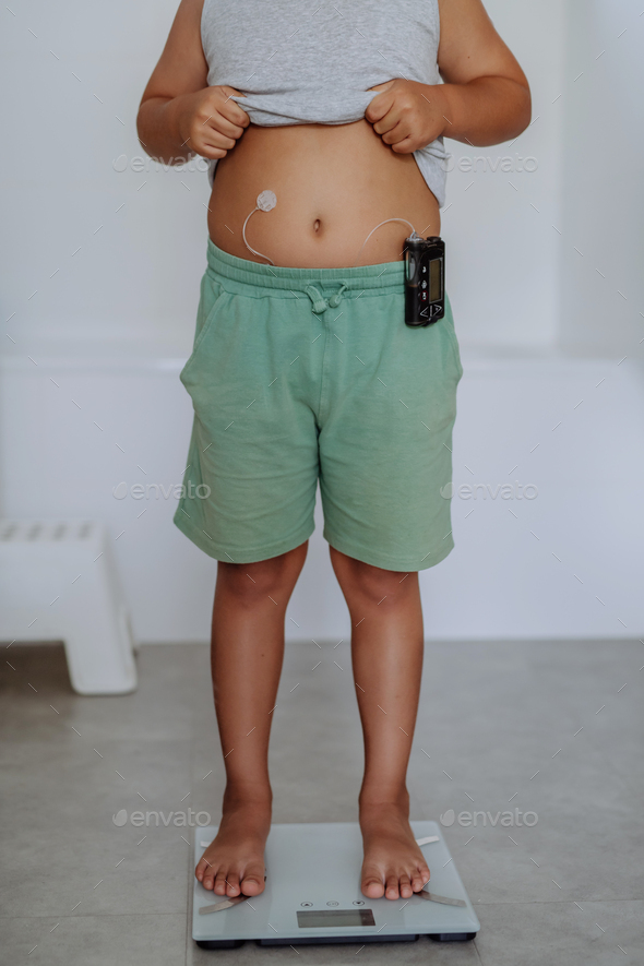 A young boy with diabetes weighing himself on bathroom scale