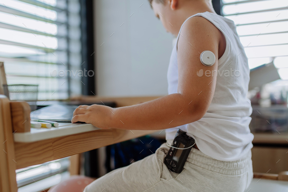 The diabetic boy doing homework, while wearing a continuous glucose monitoring sensor on his arm.